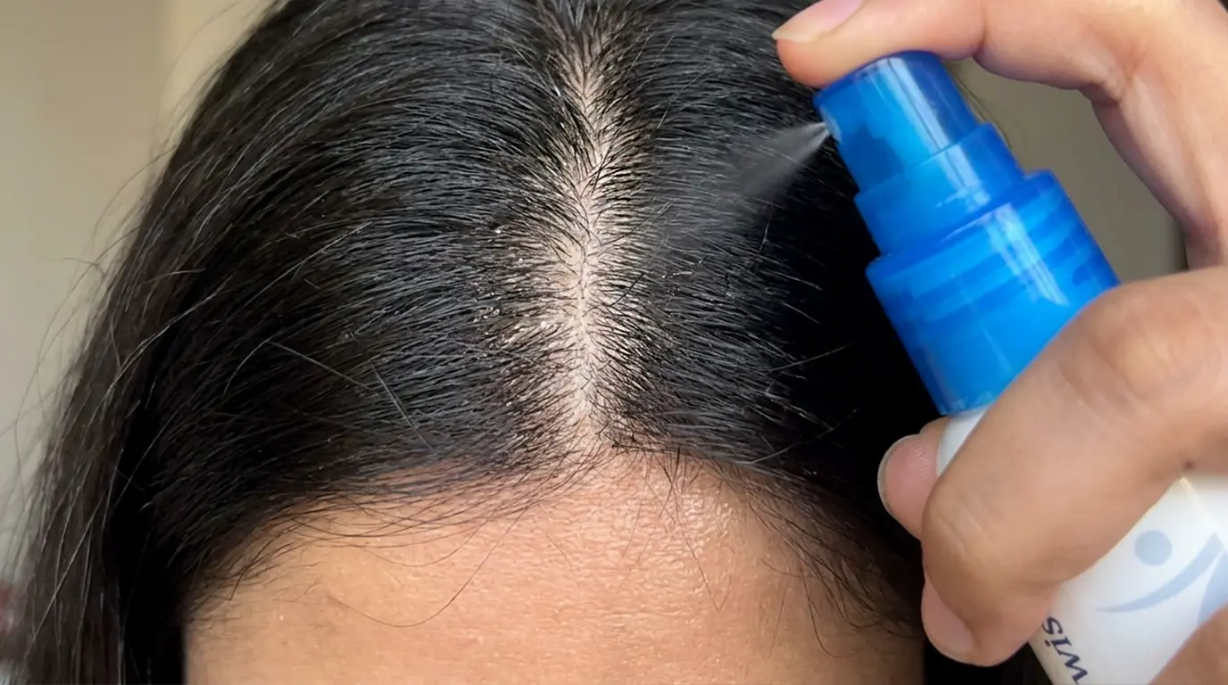 Aplicación del Bodywise Hair Growth Serum en el cuero cabelludo